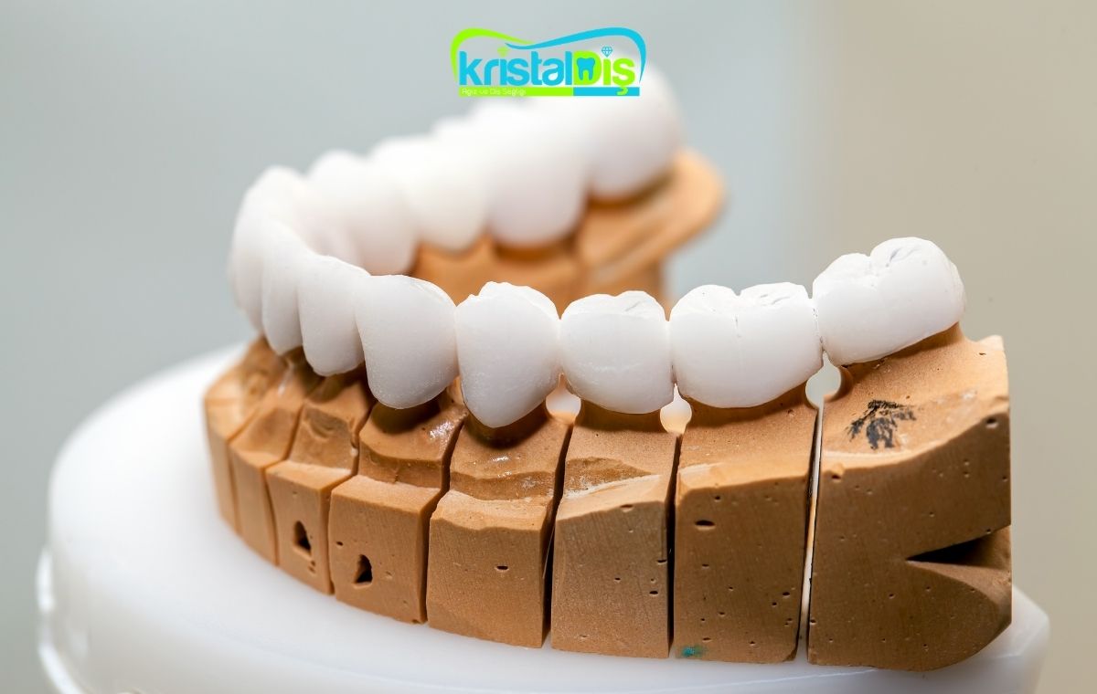 Vidalı İmplant Üstü Zirkonyum