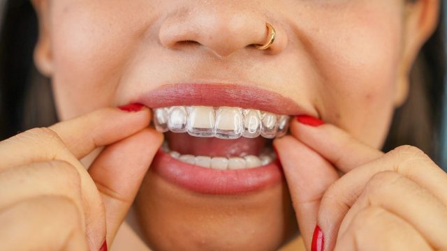 Invisalign Şeffaf Plak Tedavisi